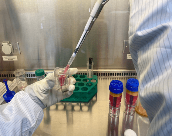 상층액을 따라내고 SVF를 분리하는 과정 (사진제공=연세사랑병원)