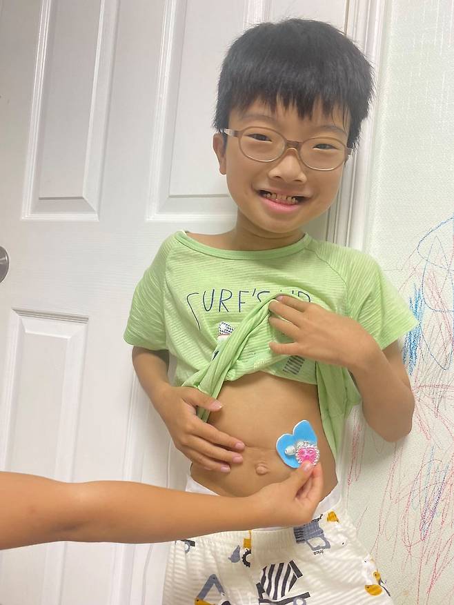 이다래(44)씨가 아들 한지민(12)군의 위루관 주변을 감싸는 패드를 하트로 잘라 붙여 주었다. 사진 독자