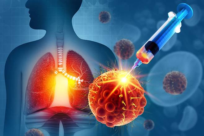 기사의 이해를 돕기 위한 이미지./사진=한림대동탄성심병원 제공