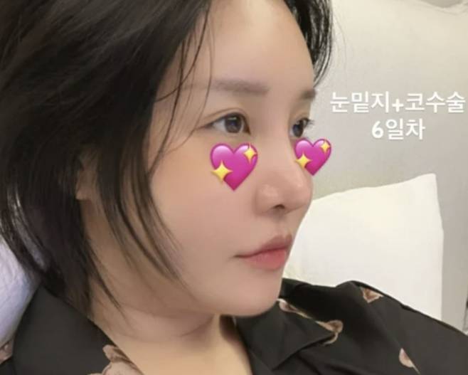 랄랄 인스타그램