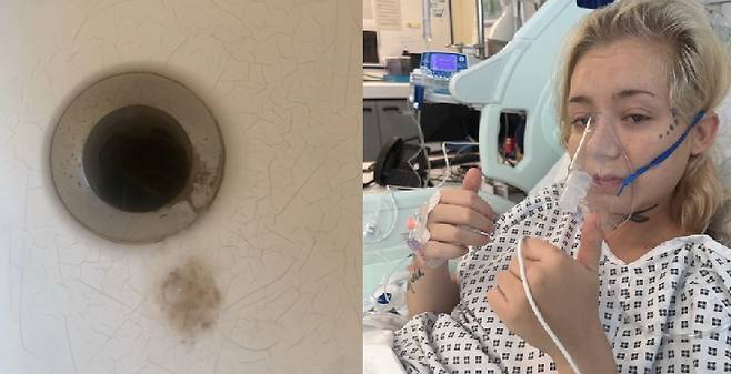 15살 때부터 전자담배를 사용해 온 케일리 보다(22)는 폐암 진단을 받은 뒤 재발해 결국 18개월 시한부 판정을 받았다. 갈색 덩어리와 입원 후 케일리의 모습/사진=더선