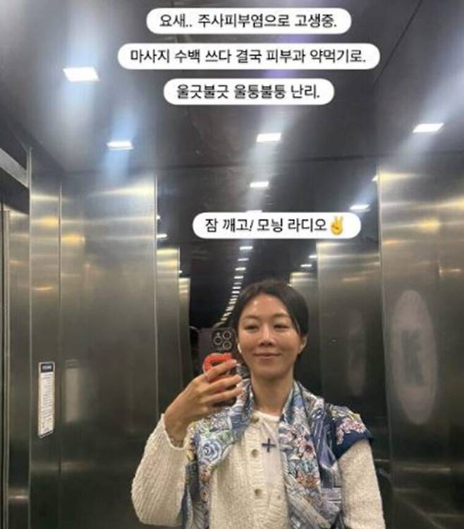 서현진이 주사피부염으로 고생 중인 근황을 공개했다. 사진=서현진 SNS