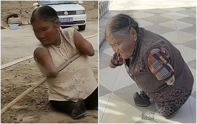 팔뚝에 빗자루를 끼워 비질을 하고 있는 왕위시씨. 바이두 캡처