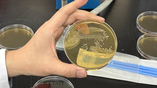 인큐베이터 배양 과정을 거쳐 균주가 점 형태의 집락을 형성했다. 김혜린 기자 sinnala8@donga.com