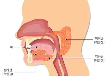 입안으로 침을 분비하는 침샘은 여러 부위에 걸쳐 존재하는데, 두경부암 방사선 치료로 침샘이 파괴되면 부작용으로 구강건조증이 나타나기 쉽다. 보건복지부 제공