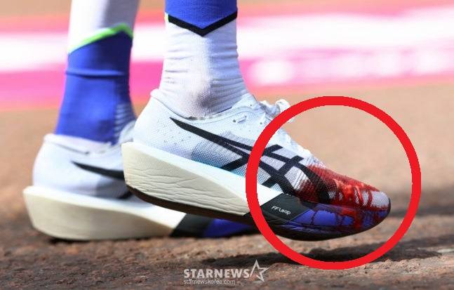 에일리스 맥콜건의 런닝화가 피로 물들어 있다. /로이터=뉴스1