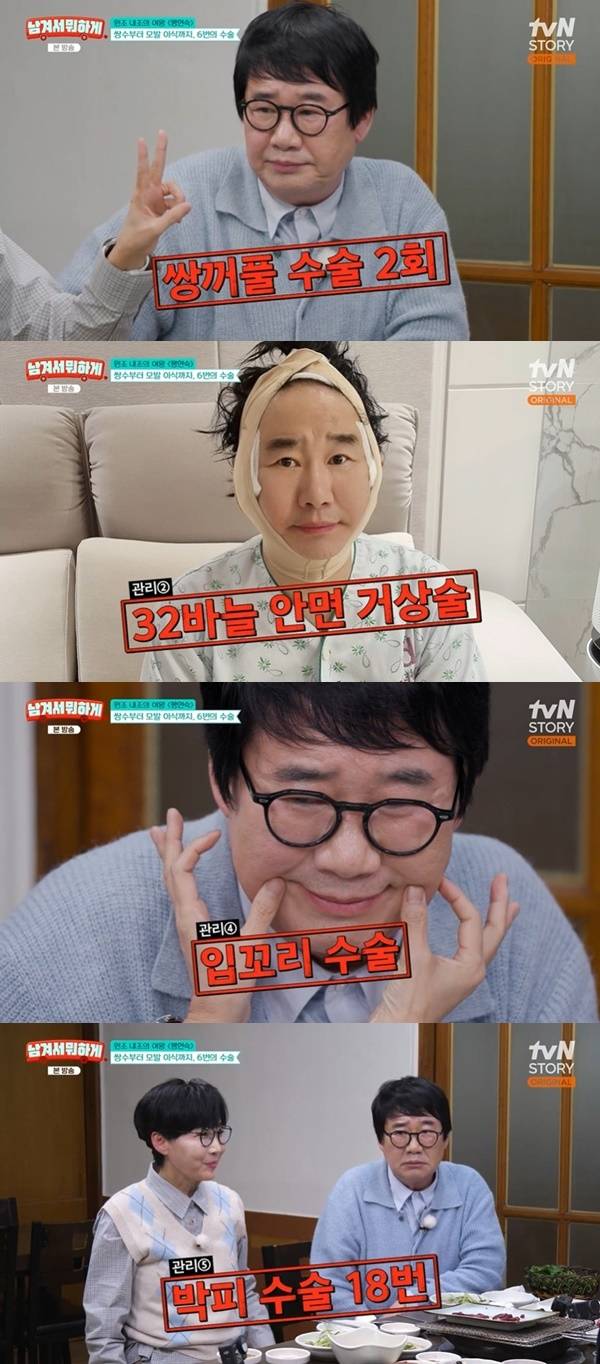 개그맨 최양락이 안면거상과 박피·모발이식 등 여러 성형수술과 시술을 받았다고 털어놨다. /사진=tvN STORY '남겨서 뭐하게'