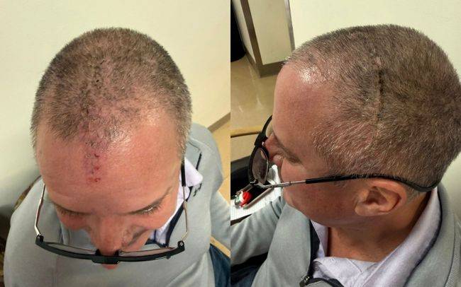 [사진] 마크 투세이커 SNS