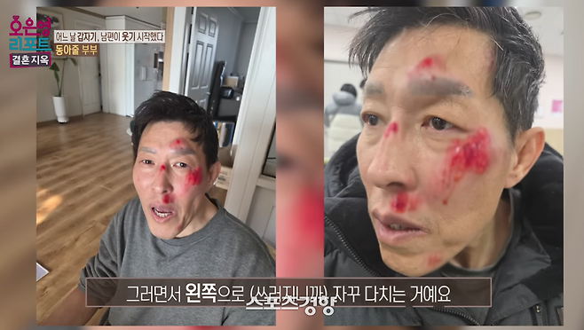 MBC ‘오은영 리포트-결혼 지옥’ 캡처.