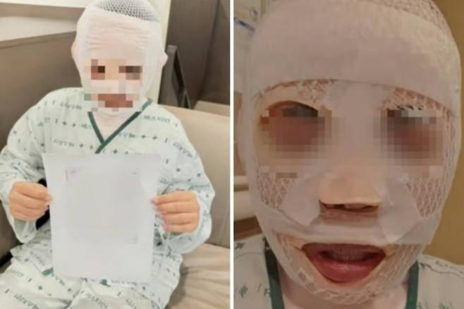 잠자는 태국인 아내 얼굴에 끓는 물을 부은 40대 남성에게 검찰이 징역 3년을 구형했다. 사진은 피해를 본 아내가 온라인 공간에 도움을 요청하면서 공유한 것. /사진=SNS 갈무리