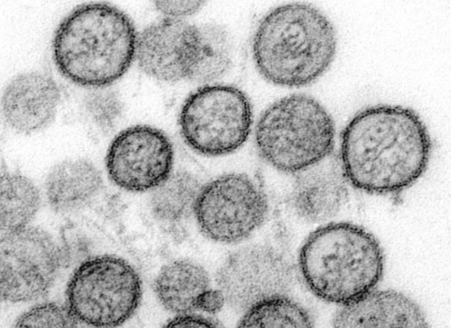 한타바이러스/사진=미 질병통제예방센터(CDC)