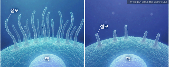 자폐 관련 유전자 쌍 중 하나만 변이가 일어날 때(왼쪽)와 둘 다 변이가 일어날 때 섬모 길이의 차이. 유전자 쌍이 함께 변이가 생길 때 세포 표면의 섬모 형성이 뚜렷하게 감소했다. 분당서울대병원 제공
