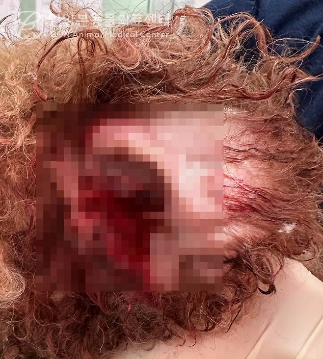 귀에서 출혈이 멈추지 않아 내원한 푸들(본동물의료센터 제공). ⓒ 뉴스1