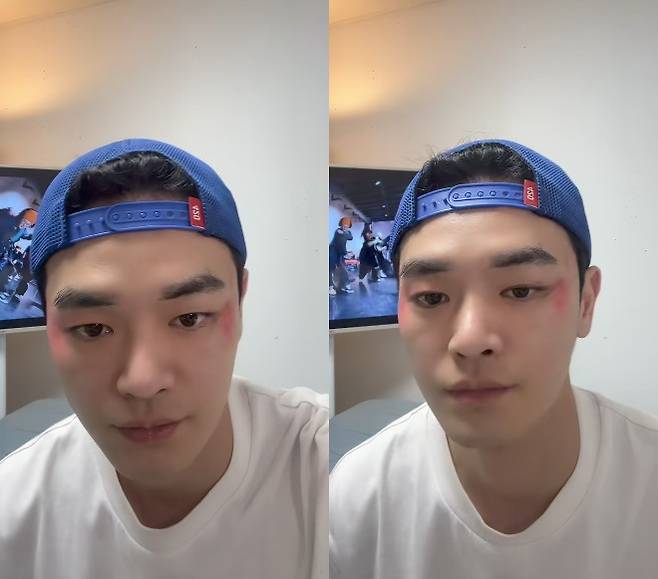 장동주 / 사진=장동주 SNS