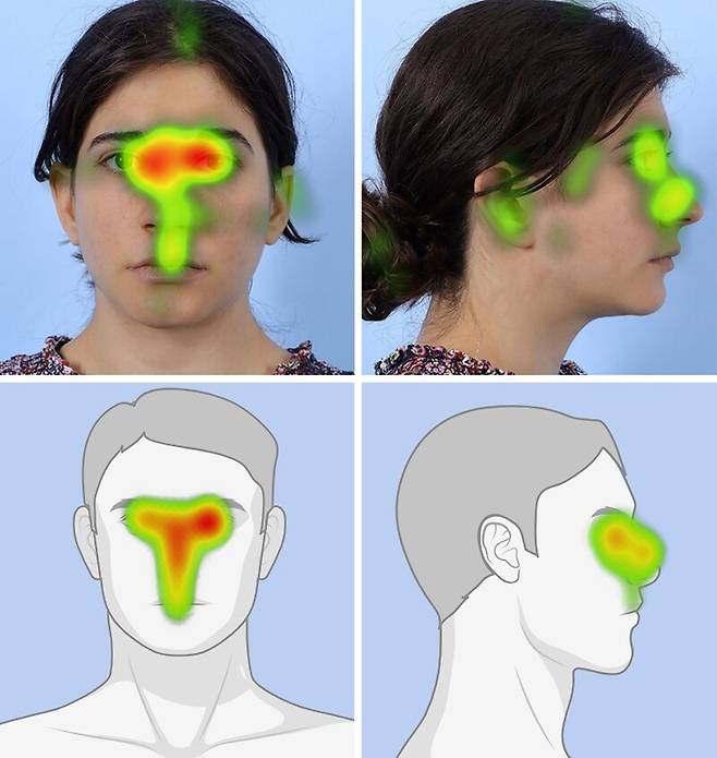 관찰자의 시선 움직임을 히트맵으로 시각화한 사진. 빨간색은 시선이 머무는 시간이 긴 부위, 녹색은 머무는 시간이 짧은 부위다. 매력적인 코를 가진 경우 눈 주변에 머무는 시간이 더 길어졌고, 코가 매력적이지 않다고 인식된 경우엔 코에 머무는 시간이 길어졌다. Plastic and Reconstructive Surgery