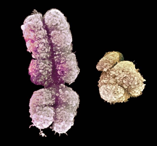 X염색체(왼쪽)과 Y염색체의 주사전자현미경 사진. /Science Photo Library