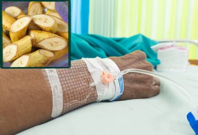 중국에서 매일 바나나를 3~4개씩 먹던 남성이 고칼륨혈증으로 정신을 잃은 사례가 전해졌다.(사진은 기사와 직접적 관련 없음) 사진=게티이미지뱅크