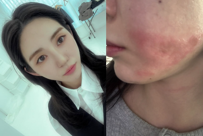 권민아. 사진| 본인 SNS
