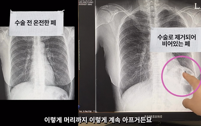 사진=이혜영 SNS