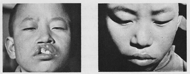 사진=Cleft Craft