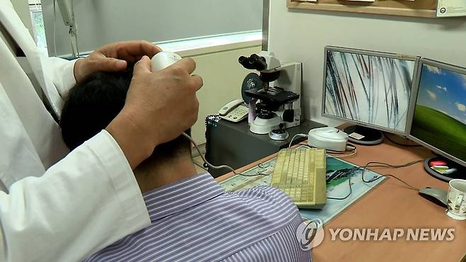남성 탈모 치료 [연합뉴스TV 캡처]
