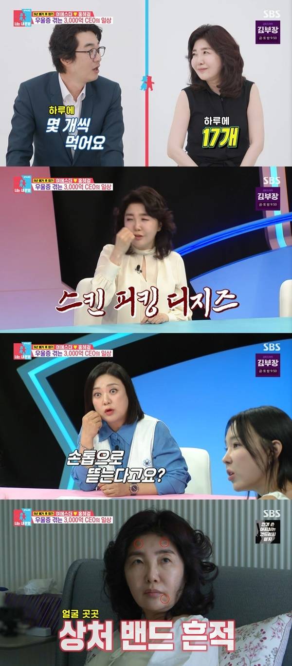 Esther Yeo appeared on the SBS variety show Same Bed, Different Dreams Season 2: You Are My Destiny and candidly acknowledged the unique habits her husband, Hong Hye-geol, had mentioned. Yeo Esther revealed that when she becomes obsessed with a particular food, she displays compulsive behavior, such as eating as many as 17 ice cream bars a day or buying the same outfit in bulk.Hong Hye-geol noted that when his wife becomes obsessed with a particular food, she tends to insist on eating nothing but that for an entire month, describing her behavior as psycho-like. Yeo Esther readily accepted her husbands observation, adding that she, too, thinks she acts like a psycho.Yeo Esther also confessed that, in addition to her food habits, she suffers from skin-picking disorder, a habit of constantly picking at pimples on her face. In response, Seo Jang-hoon expressed empathy, sharing a similar habit of picking at his skin whenever something pops up because it bothers him.