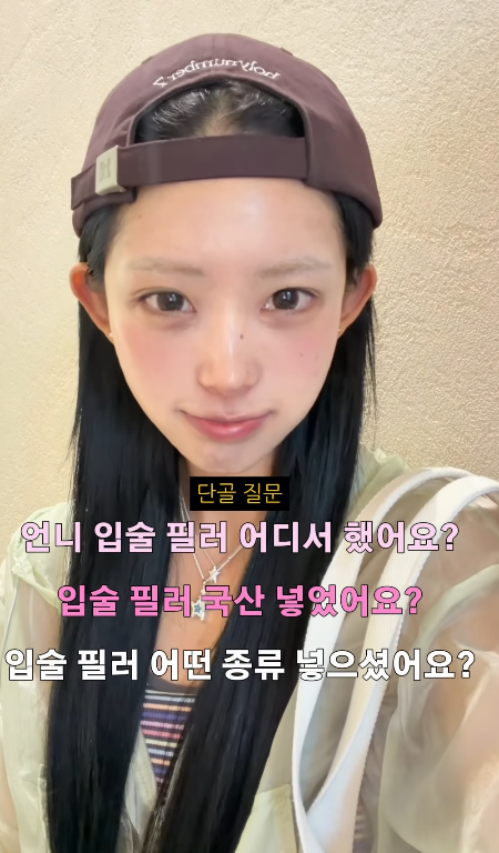 Choi Jun-hee revealed on her social media that she has been getting lip fillers since she was 18 and posted a related video. She has always been open about her plastic surgery and cosmetic procedures, and this time, too, she showed her unfiltered side by introducing the products used in detail.Regarding the released video, netizens have responded with a mix of positive comments praising her confident attitude and concerns about the frequency of her procedures. Choi Jun-hee has consistently disclosed her past cosmetic surgeries, including double eyelid surgery, rhinoplasty, and facial contouring.Choi Jun-hee, who maintains her weight through rigorous self-care, has recently garnered significant public attention after announcing her engagement. Her candid sharing of daily life consistently sparks buzz and continues to draw widespread attention.
