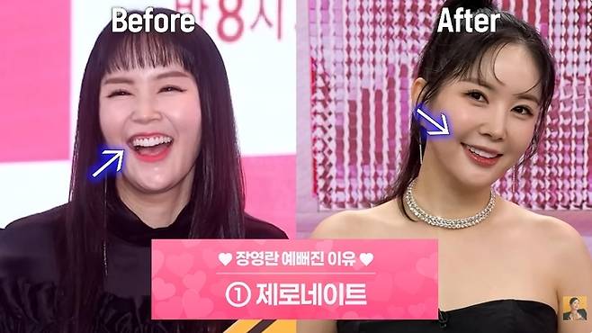 장영란. 사진 | 유튜브 채널 ‘A급 장영란’