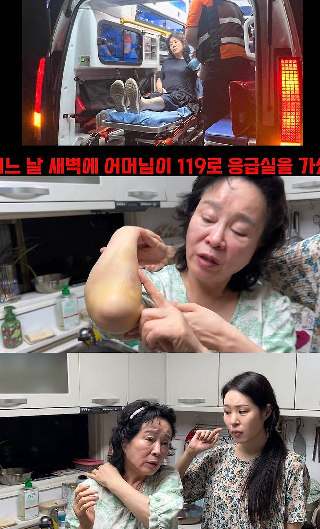 Jeon Seong-ae, the mother of comedian Mirja Boes and an actress herself, was recently rushed to the emergency room after slipping and falling in the bathroom. Mirja Boes shared the details of the incident and announced the news of her mothers injury on her YouTube channel.Jeon Seong-ae slipped and hit the sink while coming out of the bathroom after washing her hair. Mirja Boes described the situation as a severe impact that made a loud noise, stating she was so shocked that she initially thought her mother was seriously injured.Jeon Seong-ae recalled feeling her life was in danger at the time of the accident, fearing a possible cerebral hemorrhage. Fortunately, her condition has improved without any major aftereffects, and she is currently resting.An anecdote was shared about her husband, Jang Kwang, panicking and attempting to apply a cold compress using frozen sujebi (Korean hand-pulled dough soup). Jeon Seong-ae added that the accident served as an opportunity for her to reflect on her past life.