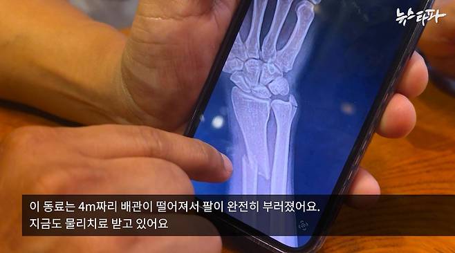 지난 4월, KTX공사현장에서 작업 중 배관이 떨어져 팔이 부러진 이주노동자의&nbsp;X-ray 사진. 해당 노동자는 열흘 간 입원하고, 수술을 받았다. 하지만 산업안전보건법에 따른 노동부 산재 보고는 이뤄지지 않았다.