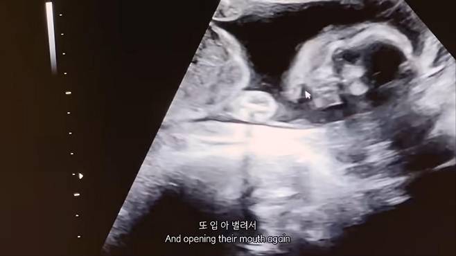 출처:안나 유튜브 캡처