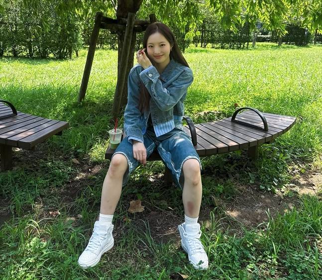 다리에 멍자국이 있는 혼다 마린. /사진=혼다 마린 공식 SNS