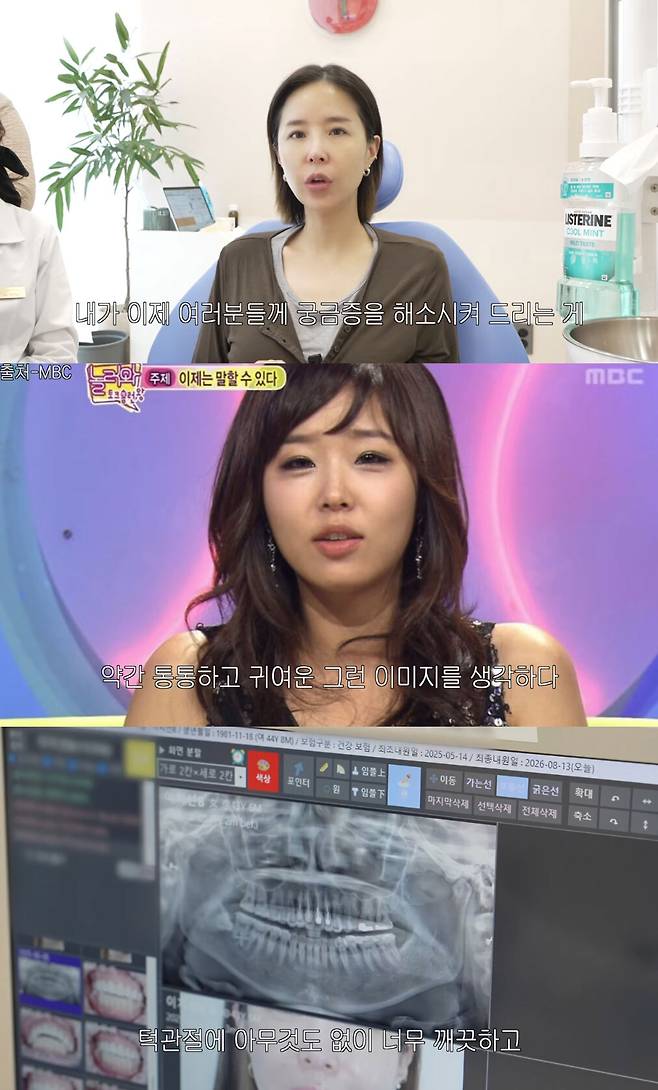 양악수술 의혹을 해명하며 치아 치료 과정과 엑스레이를 공개한 신지. 유튜브 채널 ‘어떠신지?!?’ 캡처