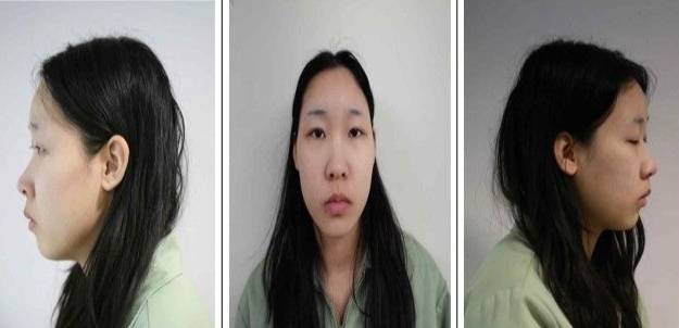 '모텔 약물 살인' 피고인 김소영(20)./사진=서울북부지검.