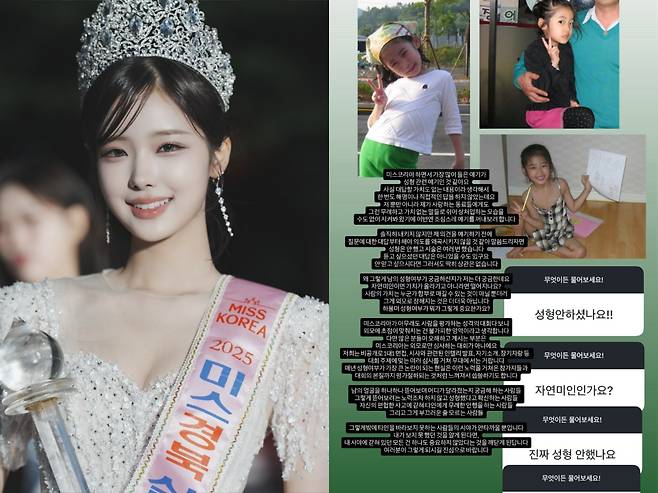 ▲ 정연우. 출처| 정연우 인스타그램