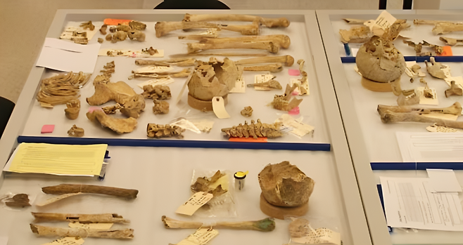 하와이에 위치한 미 국방부 전쟁포로·실종자확인국(DPAA) 산하 실험실에서 한국계 법의학 인류학자인 제니 진 박사가 북한으로부터 송환된 6.25 전쟁 미군 전사자 유해의 신원을 확인하기 위한 정밀 감식 작업을 진행하고 있다. VOA