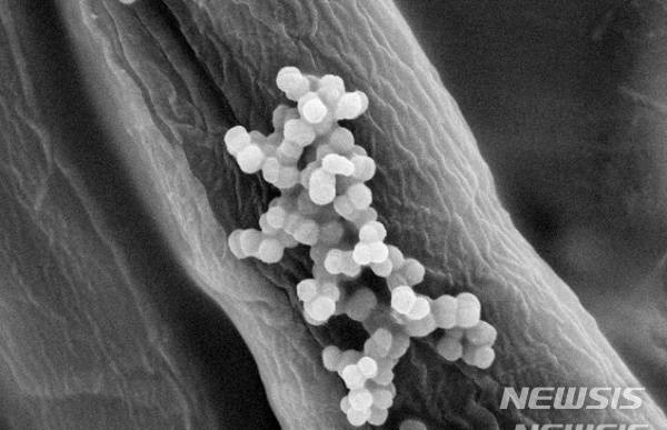 [서울=뉴시스]크론병 환자의 예후는 장내 미생물의 다양성 감소 및 구성 변화와 관련이 있다는 국내 연구 결과가 나왔다. (사진= 뉴시스DB) 2021.04.22