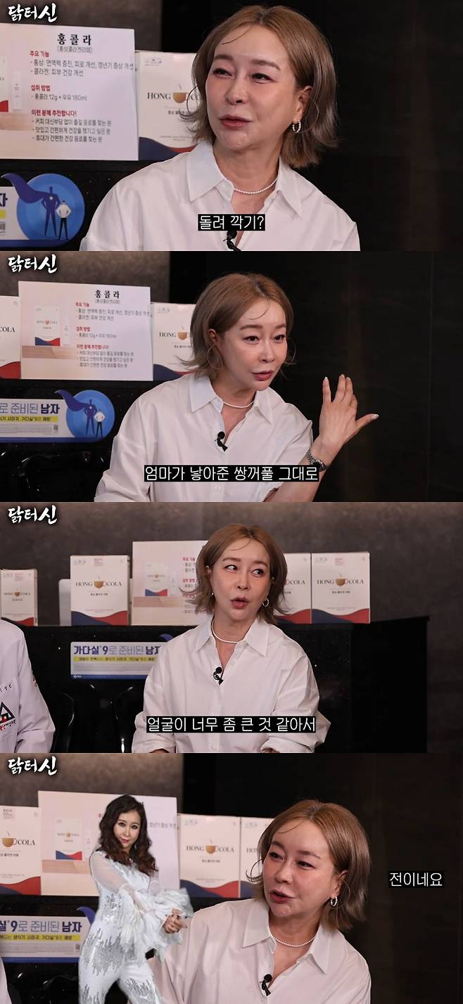 Rulas Kim Ji-hyun candidly revealed the reason she underwent double jaw surgery.On the 16th, a video titled Even Charismatic Kim Ji-hyun Cant Do It Here was released on the YouTube channel Dr. Shin.On that day, Shin Jung-hwan asked Kim Ji-hyun, Is it true that you received sponsorship for the jaw reduction surgery?Kim Ji-hyun coolly admitted this, but emphasized, What I can say with absolute confidence is that I havent touched the double eyelids, nose, or mouth that my mother gave me at all.She then honestly confessed the reason she decided to have plastic surgery, saying, I felt like my face was too big.Looking at a photo of Kim Ji-hyun before the surgery, Shin Jung-hwan jokingly remarked, You did well, adding, I thank your surgeon once again. You look better now.In response, Kim Ji-hyun admitted, I think so too. She added, Sometimes people around me call me after seeing my old photos. They ask, You were pretty back then, why did you get jaw surgery?However, Shin Jung-hwan drew laughter by emphasizing once again, No. Its better that I got it fixed. Ill say it again: its better to have received the power of medicine.