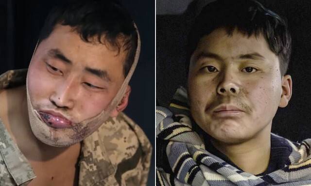 블로디미르 젤렌스키 우크라이나 대통령이 텔레그램을 통해 공개한 생포 북한군 병사들의 모습. 젤렌스키 엑스 캡처