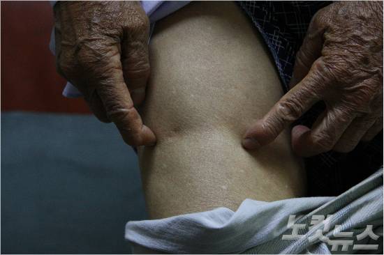 박동수 할아버지가 4.3당시 지서에 끌려가 구둣발로 밟혔던 왼쪽 허벅지를 손으로 가리키고 있다. 허벅지는 움푹 패어 있었다. (사진=문준영 기자)