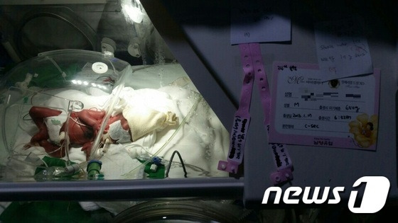 병원에서 치료 중인 이른둥이(초록우산 어린이재단 전남지역본부 제공) ./뉴스1 © News1 전원 기자