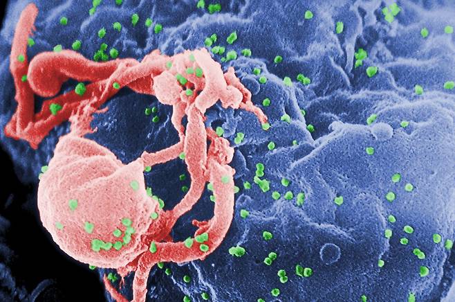 인체 면역세포(빨간색)를 파괴하고 나오는 에이즈 바이러스(초록색). [중앙포토]