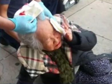 작년 2월 정신 이상의 한 여성으로부터 묻지마 폭행을 당한 할머니/유튜브 캡처