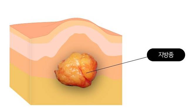%eb%b4%84%eb%82%a0%ec%9d%98%ec%99%b8%ea%b3%bc-%ed%95%9c%ea%b5%ad%ea%b2%bd%ec%a0%9c_180308