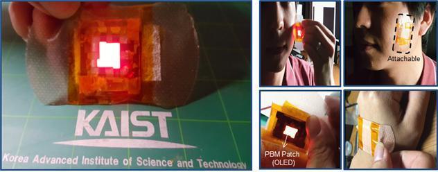 KAIST 연구진 붙이기만 해도 상처 치유가 가능한 OLED를 개발했다.