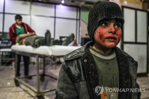 시리아 친정부군 공습으로 다친 어린이 [EPA=연합뉴스]