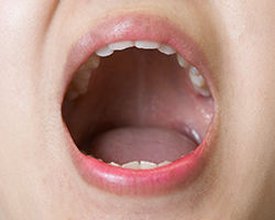코 대신 입으로 숨을 쉬면 각종 질환에 감염될 위험이 커지고 얼굴이 변형될 위험도 있다./사진=헬스조선 DB