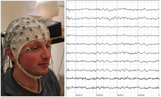 왼쪽: EEG를 측정하기 위해 준비한 모습, 오른쪽: 뇌파의 예시. 가로축은 시간을 나타낸다. /출처=https://commons.wikimedia.org/wiki/File:Human_EEG_without_alpha-rhythm.png,  https://www.flickr.com/photos/tim_uk/8135749317