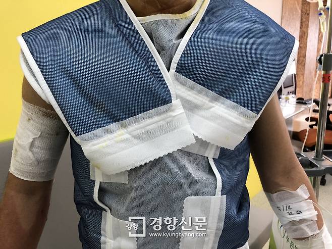 16일 대구 지역 한 병원에서 치료를 받고 있는 ㄴ씨의 모습. 그는 얼굴과 팔, 다리 등에 2도 화상을 입었다.｜백경열 기자 merci@kyunghyang.com