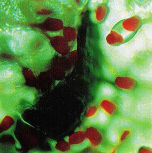 끈끈이주걱이 포획한 곤충을 소화시키는 현미경 사진 - 과학동아 제공